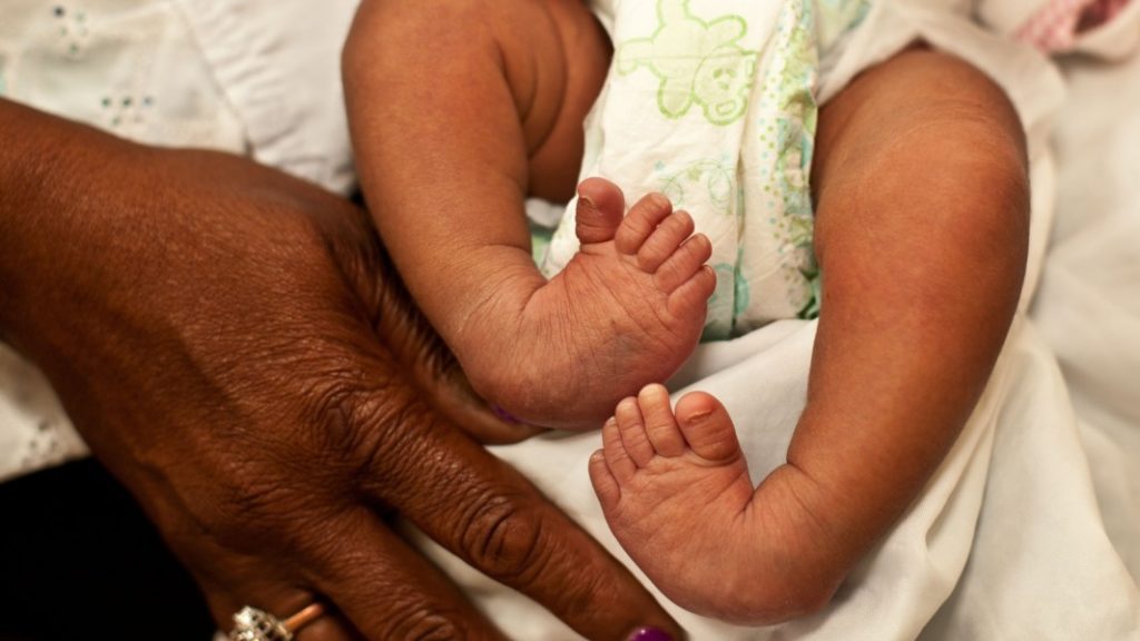 baby-s-clubbed-feet-and-the-solution-mothersbond